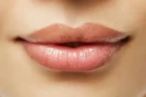 aumento de labios colombia