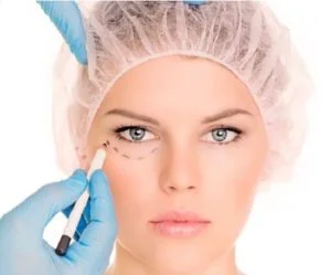 Cirugia de parpados en colombia