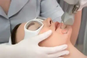laser resurfacing colombia