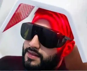 tratamiento de alopecia colombia