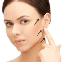 Ritidoplastia en Colombia Ritidoplastia en Colombia